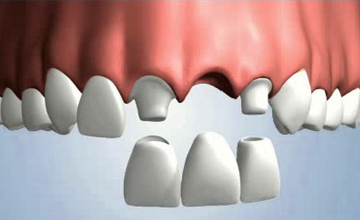 Soul Family Dentalbridge service